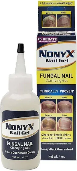 Nonyx Nail Gel