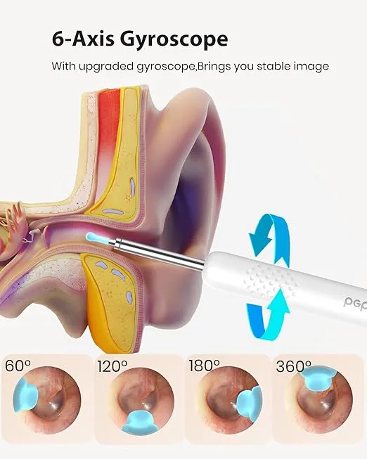 BEBIRD Wax Removal Tool Camera - Ear Canal Cleaner with 1080P Camera, Ear Scope Otoscope with Light, 10 Tips + 6 Ear Picks + 3 Speculum Sets, White